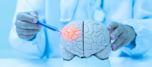 What to Expect During Your Concussion Therapy Sessions | Prime Physical Therapy Near Me in Lee’s Summit, MO